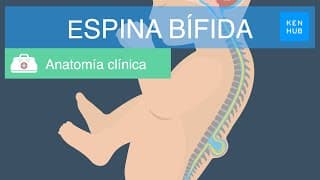 Portada del video Espina bífida: definición, causas, tipos, prevención y tratamiento